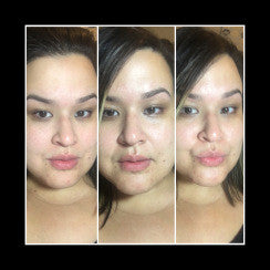 Before and After photos HA7X Serum