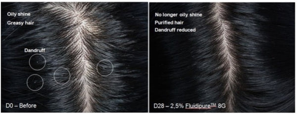 All about Fluidipure 8G in RevivScalp and RevivHair Stimulating Shampoo