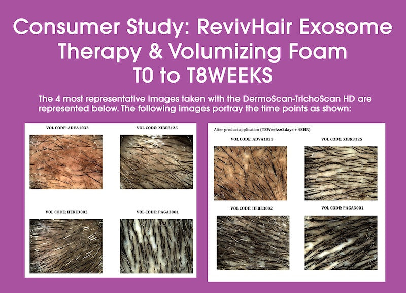 RevivHair Exosome Therapy & Volumizing Foam