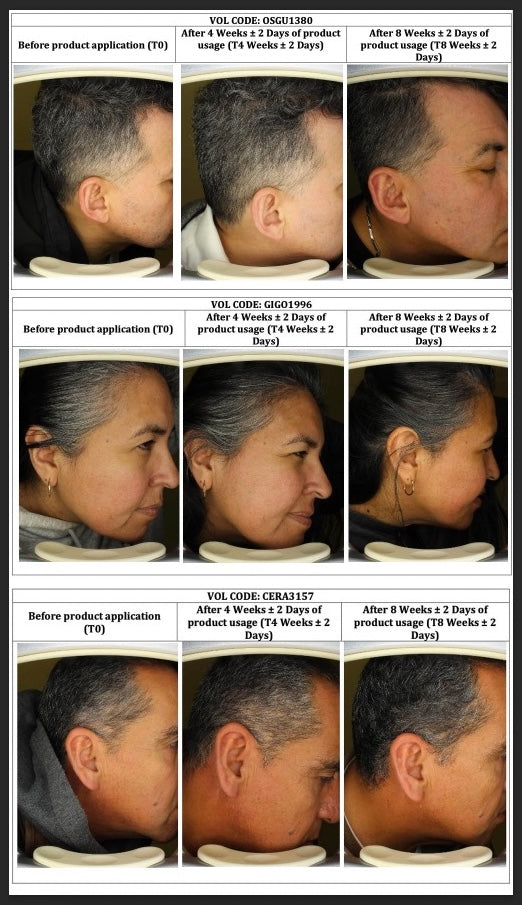 Redensyl power image