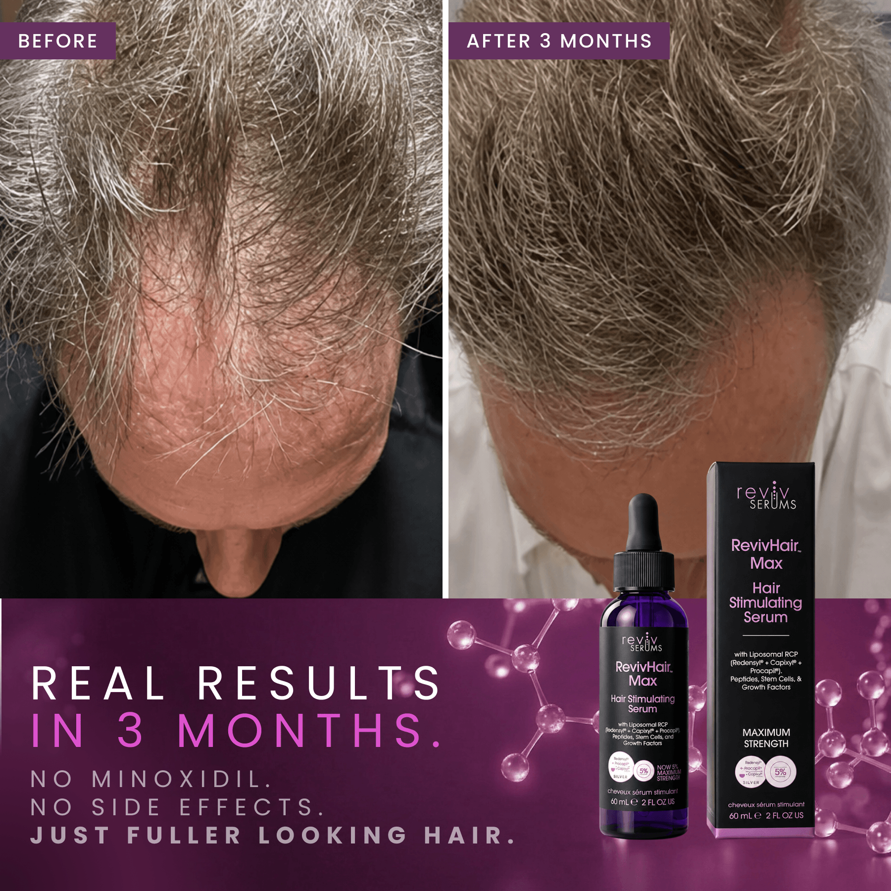 RevivHair Max Hair Stimulating Serum with 5% Redensyl