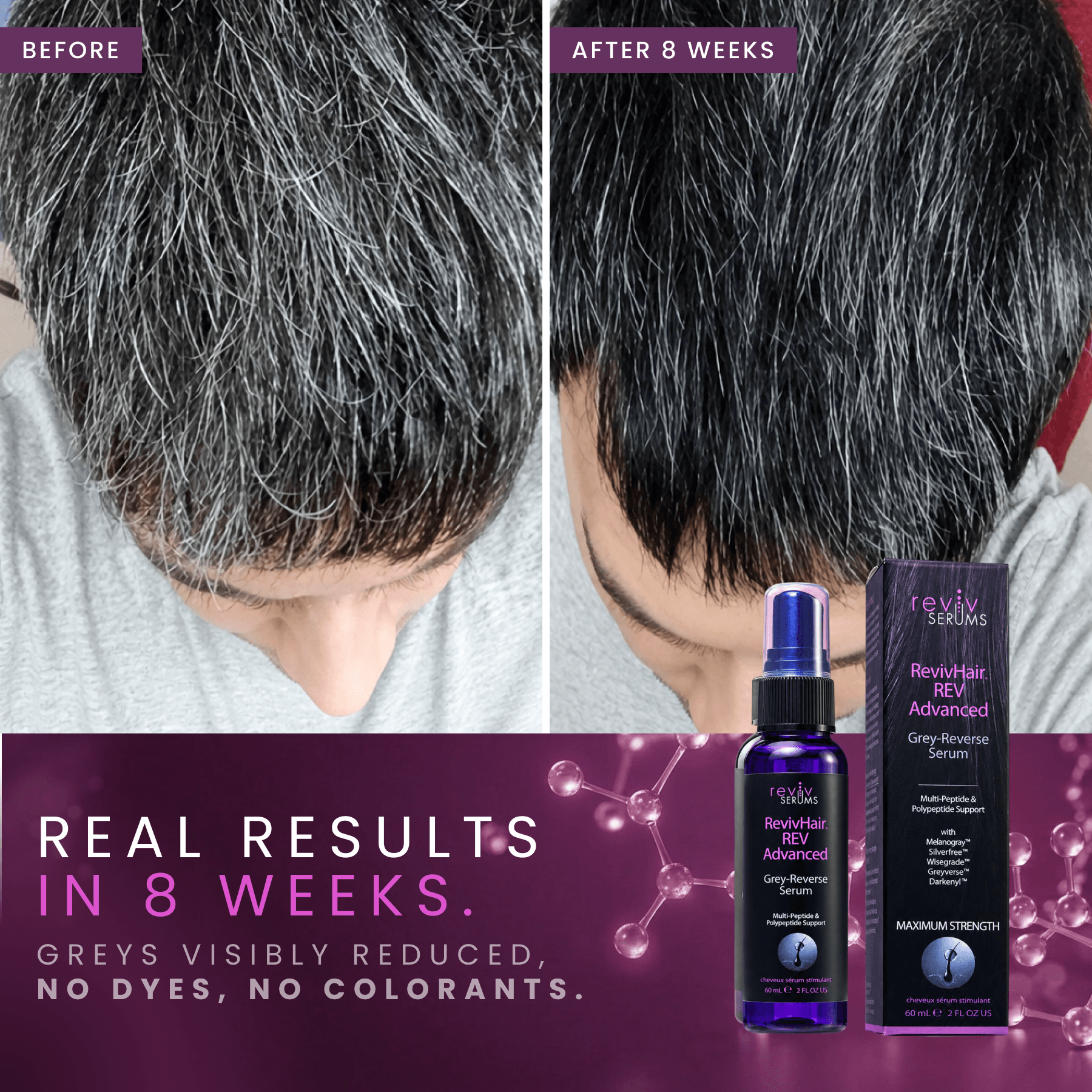 RevivHair REV Advanced: Grey Hair Reverse Serum with MelanoGray & Greyverse