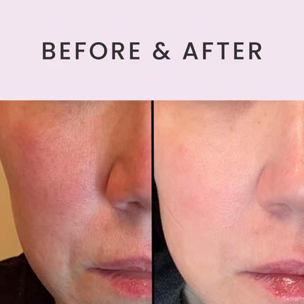 Ultimate Serum - now with exosomes!