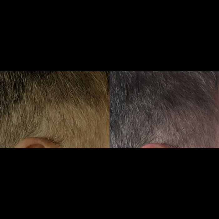 RevivHair REV Advanced with Grey Hair Reverse MelanoGray + Greyverse + Darkenyl RevivSerums.com RevivHair REV Advanced with Grey Hair Reverse MelanoGray + Greyverse + Darkenyl RevivSerums.com