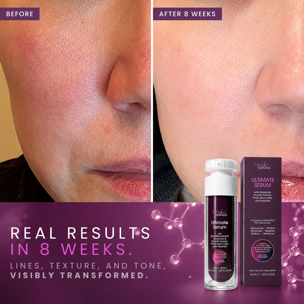 Ultimate Serum | Exosomes, Stem Cells, Growth Factors, Peptides