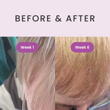RevivHair REV Advanced grey hair reverse - NEW